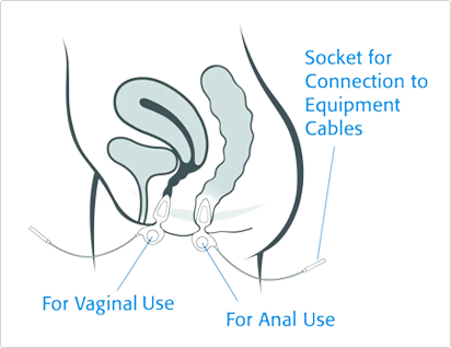 Anuform® Intra-Anal & Intra-Vaginal Probe